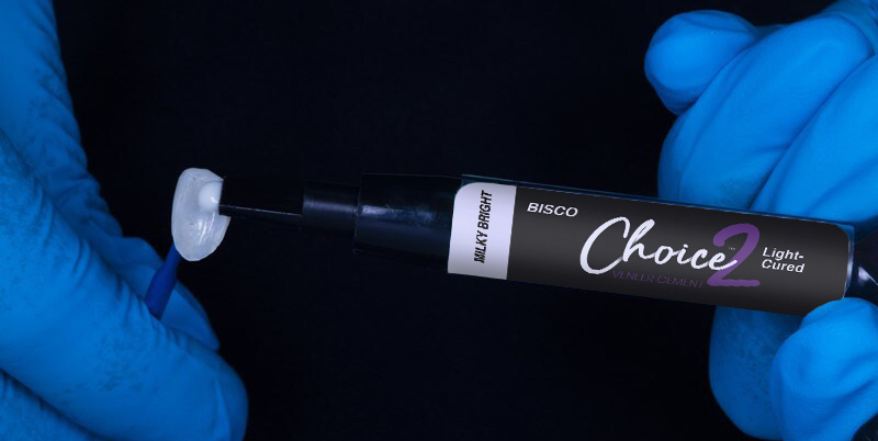 No prep veneers choice 2 veneer cement