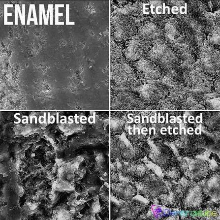 Grid photo in black and white showing enamel, enamel that has been etched, enamel that has been sandblasted, and enamel that was sandblasted then etched.