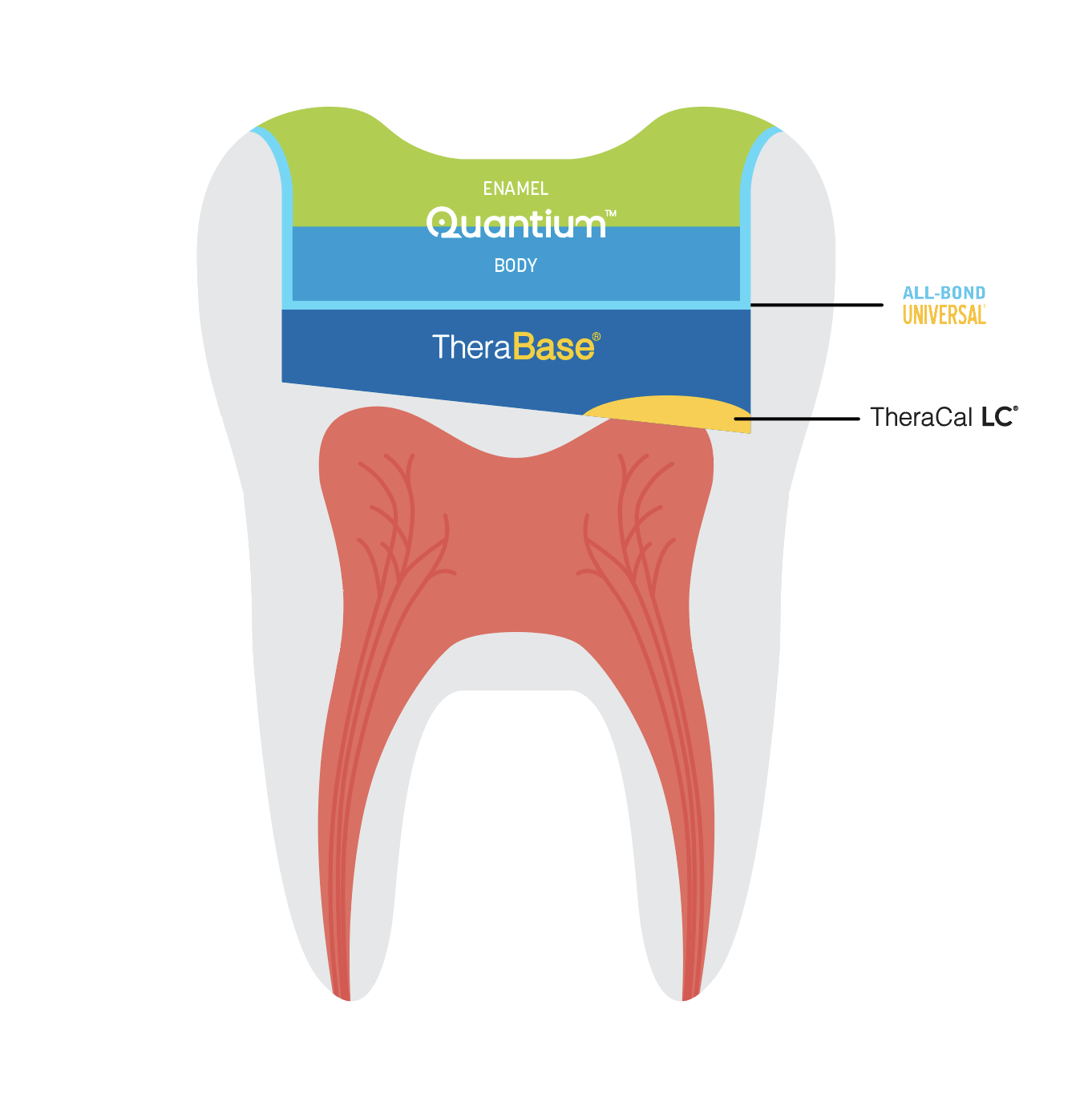 theracal lc tooth restoration graphic